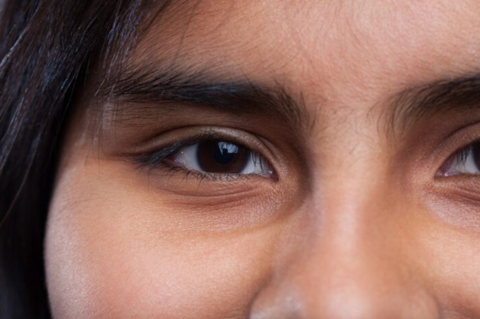 5 Cara Efektif Hilangkan Mata Panda dengan Cepat, Bikin Wajah Lebih Cerah