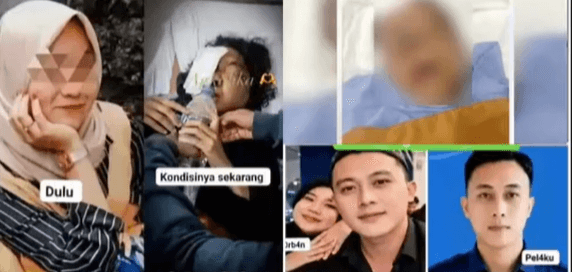 Alami Kebutaan Permanen Akibat Penyekapan dan Penyiksaan Selama 2 Tahun, Yuvita: "Kalau Saya Bersuara atau Teriak, Makin Disiksa"