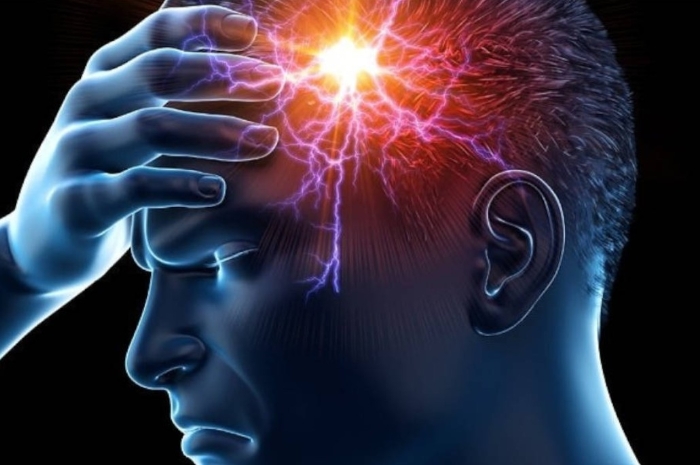 Bukan Sakit Kepala Biasa, Ini Pengobatan Medis Terbaik untuk Migrain yang Perlu Kamu Ketahui