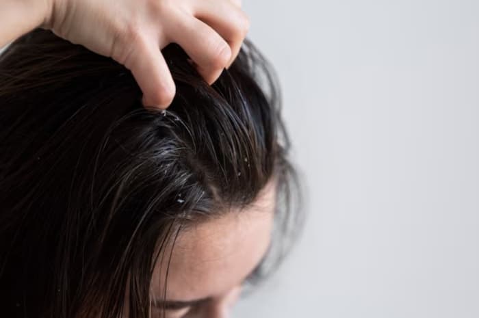 Jangan Sepelekan, Kenali 6 Tanda Kulit Kepala Butuh Istirahat dari Pewarnaan Rambut