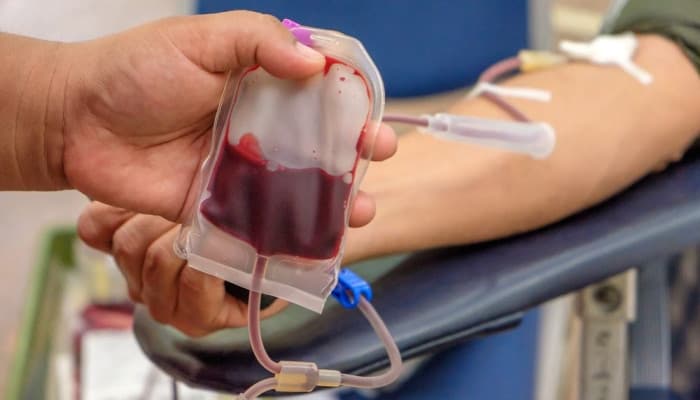 Berikut Cara Kenali Gejala Anemia dan Mencegahannya, Kamu Harus Tau