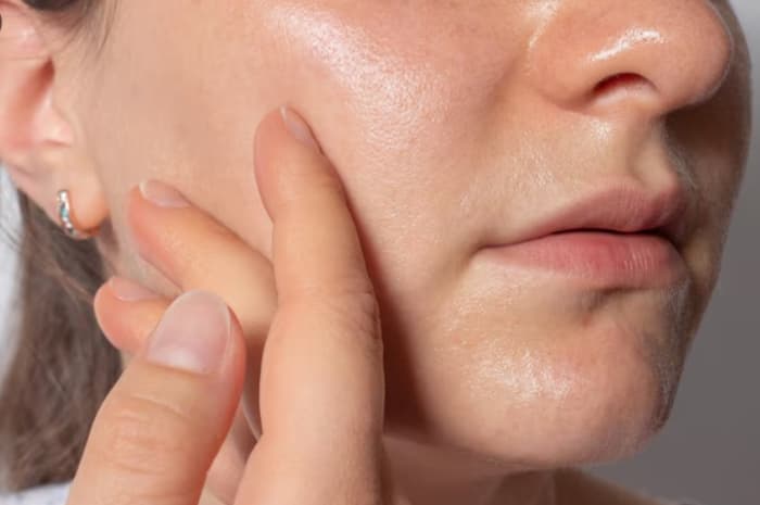 Tak Perlu Mahal, Ini 7 Cara Sederhana Mengatasi Wajah Berminyak