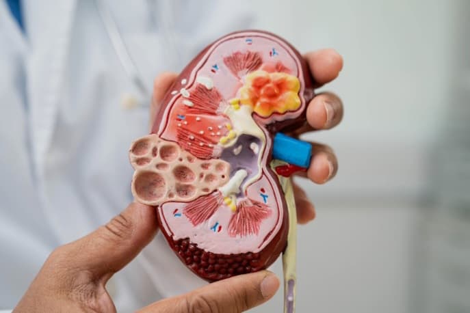 Ternyata Melindungi Ginjal Sama Dengan Menjaga Planet, Kenali 10 Gejala Gagal Ginjal Sejak Dini