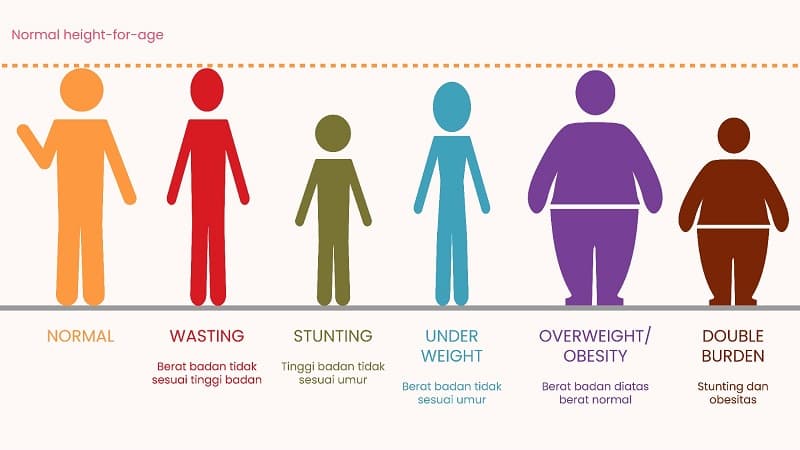 Mengenal Wasting, Gizi Buruk pada Anak Selain Stunting