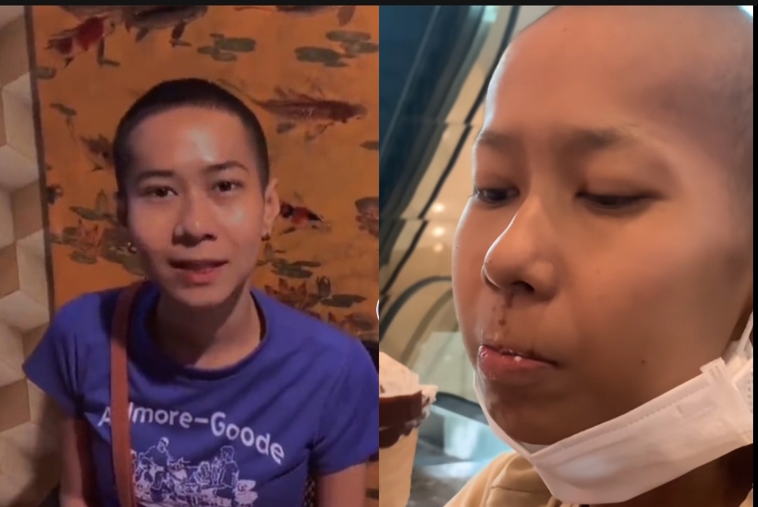 TikTokers Shella, Pejuang Kanker Ovarium Dikabarkan Meninggal Dunia