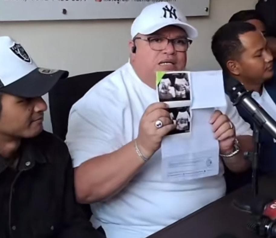 Kuasa Hukum Vadel Badjideh Beberkan Bukti Loly Negatif Hamil