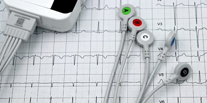 Bahaya! Berikut 3 Kondisi Jantung yang Dapat Memengaruhi Kesehatan Otak, Jangan Disepelekan