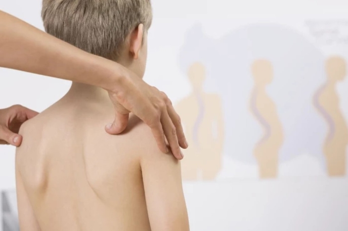 IDAI Beberkan Fakta Penting soal Gangguan Tulang Anak yang Sering Diabaikan